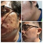 150 mlacne foaming cream cleanser cerave 11.jpg