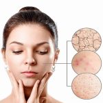 Cycalfit repairing cream from France 12.jpg