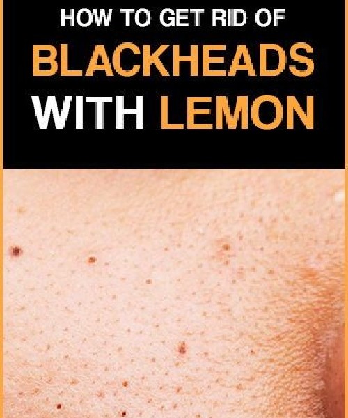 عکس دانه‌های سرسیاه روی پوست چیست؟