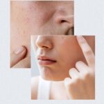 سرم بوستینگ +70 آنوا مرطوب و تقویت‌کننده پوست (30 میلی‌لیتر) - تصویر 6